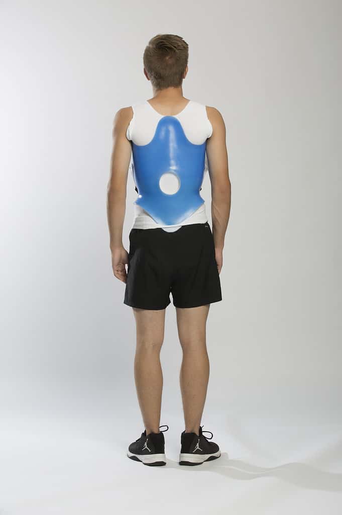 Why Refer To Scoliosis Center of LA 27 Back posture assessment with a scoliosis support brace, emphasizing chiropractic treatment for scoliosis at the Scoliosis Center of LA.