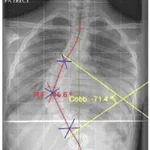 initial curve