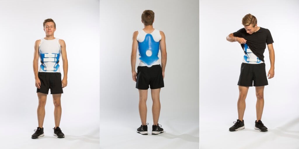 KyphoBrace 3 views kyphosis brace