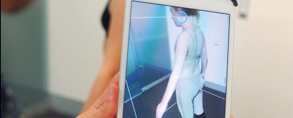 ScoliBrace 3d Custom Bracing 8 Advanced 3D posture analysis for scoliosis assessment at the Scoliosis Center of LA & Chiropractic. Precise imaging helps tailor effective treatment plans.