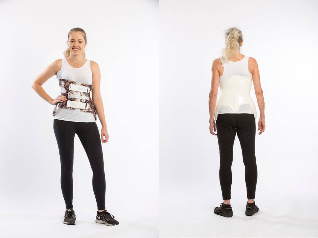 Woman wearing a scoliosis brace demonstrating adult scoliosis treatment options at the Scoliosis Center of LA & Chiropractic.